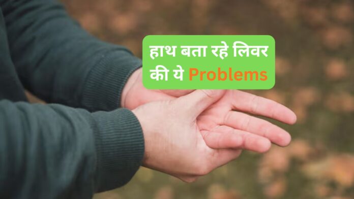 Early Signs Of Liver Disease In Hands