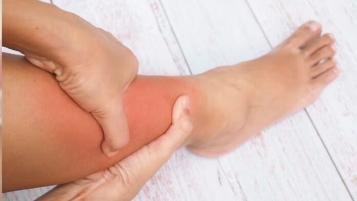 Home Remedies For Swelling