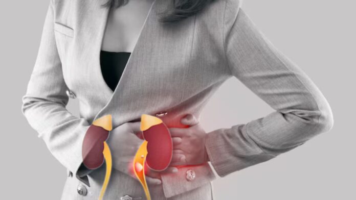 Kidney Stones Home Remedies