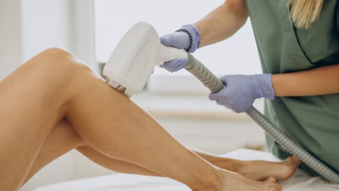 Laser Hair Removal