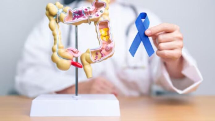 Rising Colon Cancer In Young Adults