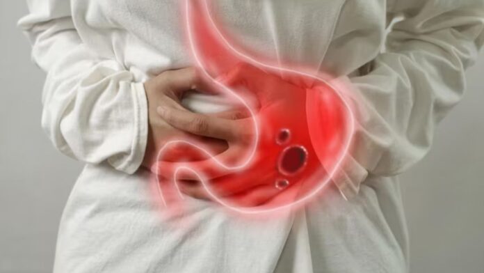 Sour Burping Symptoms