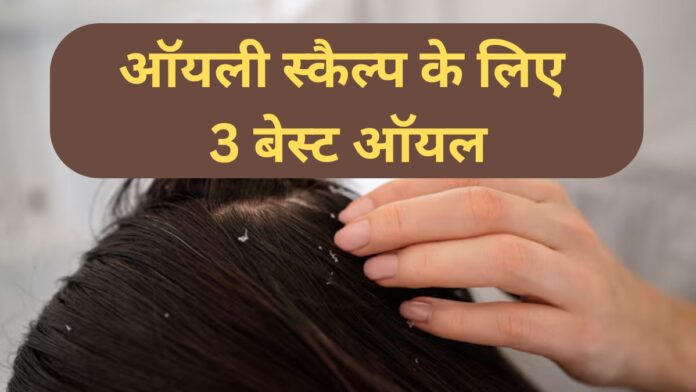 Best Oil for Oily Scalp
