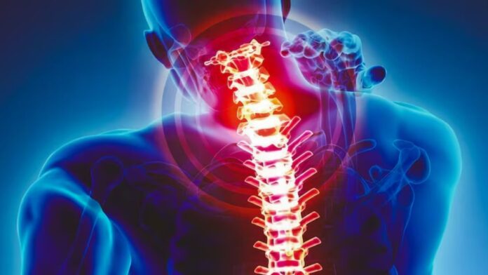 Cervical spondylosis Neck Pain Causes