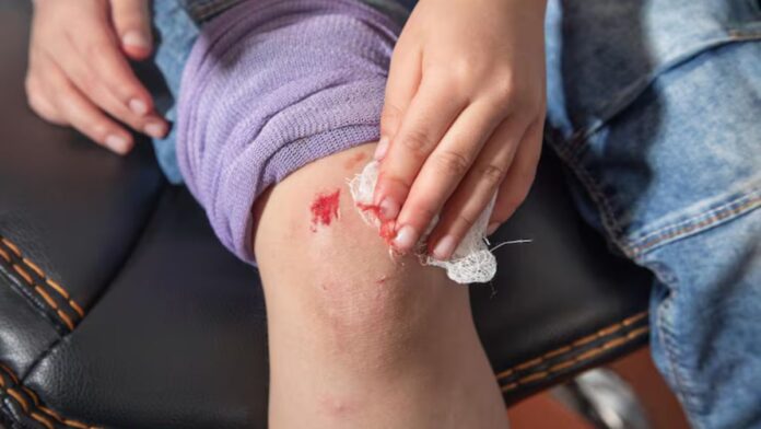 How To Treat Minor Cut