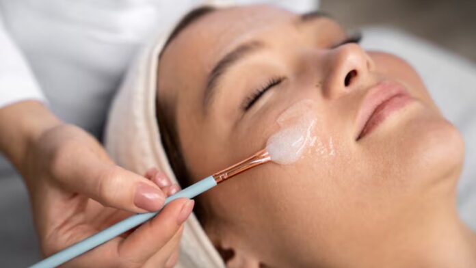 Is Chemical Peel Safe At home