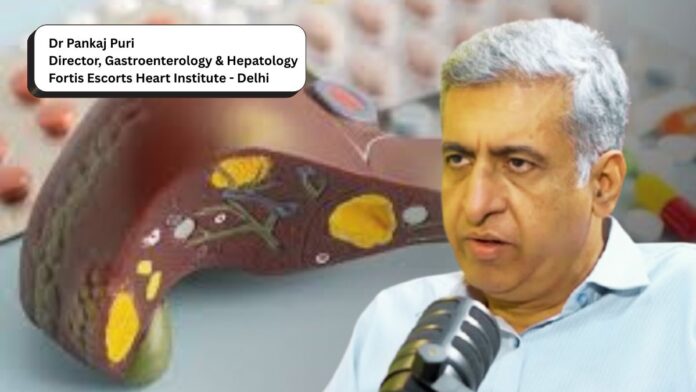 Non Alcoholic Fatty Liver Disease