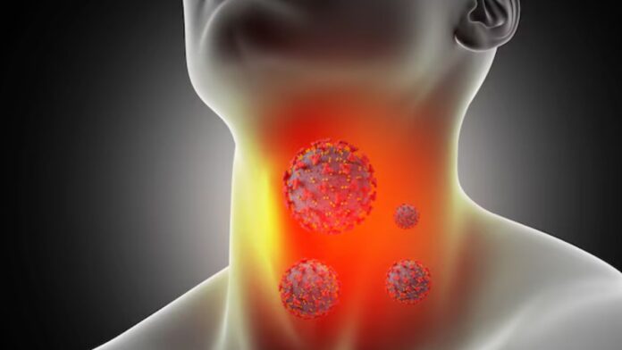 Throat irritation causes