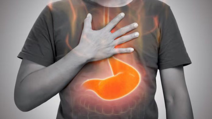 4 Home Remedies for Acidity