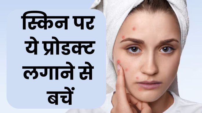 Acne Management During The Summer