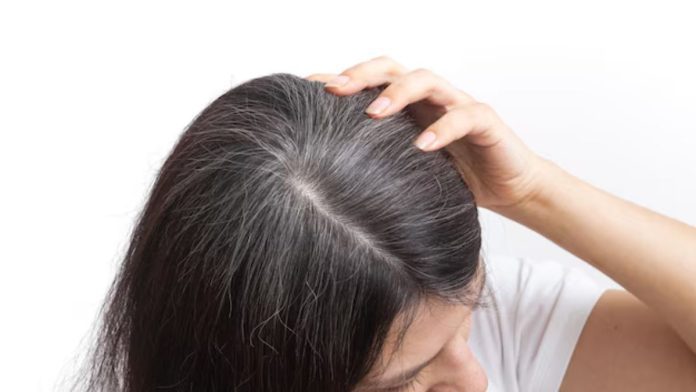 Can white hair turn black naturally