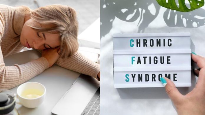Chronic Fatigue Syndrome