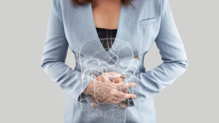 Irritable Bowel Syndrome
