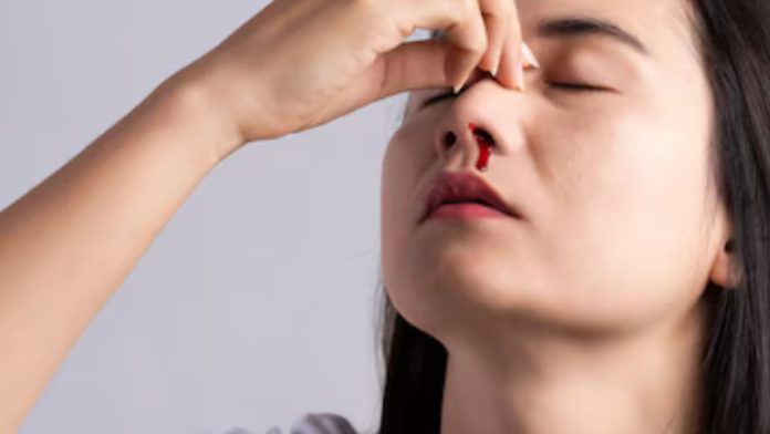 Remedies for Nose Bleeding