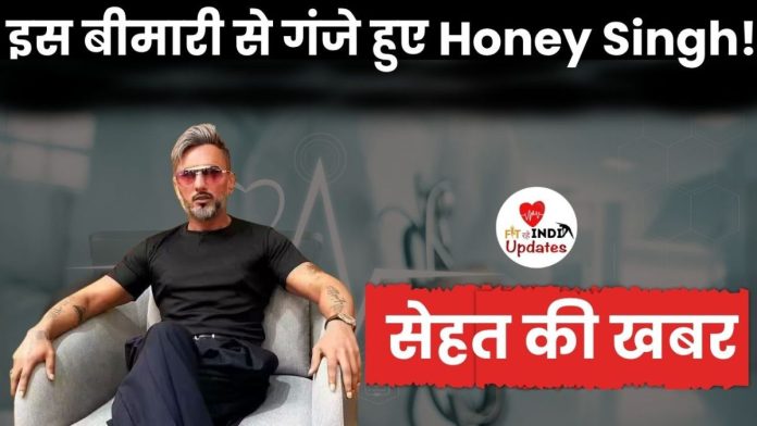 इस बीमारी से गंजे हुए थे हनी सिंह