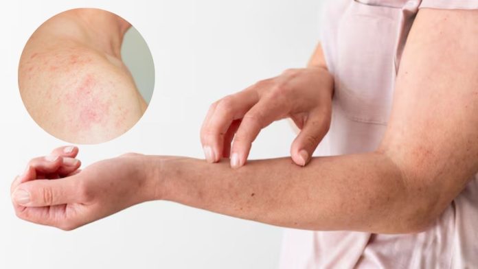 Skin Allergy problems