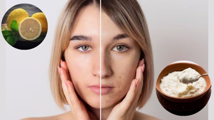 Tanning Hatane Ke Liye Home Remedies