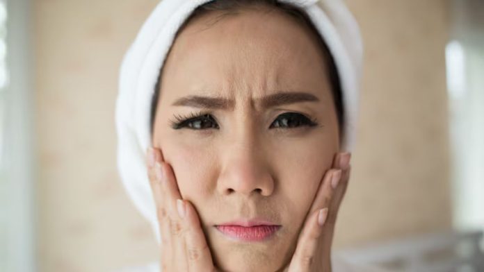What to do if face feels tight after washing
