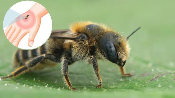 What to do if stung by a honeybee
