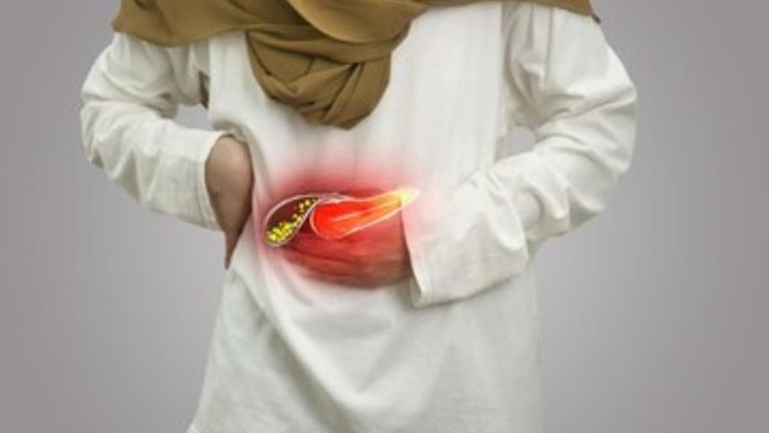 Which food is best for gallstones