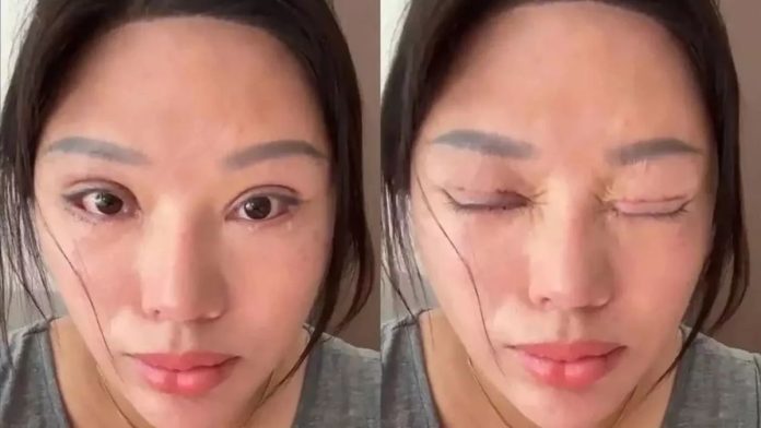 Cosmetic Surgery