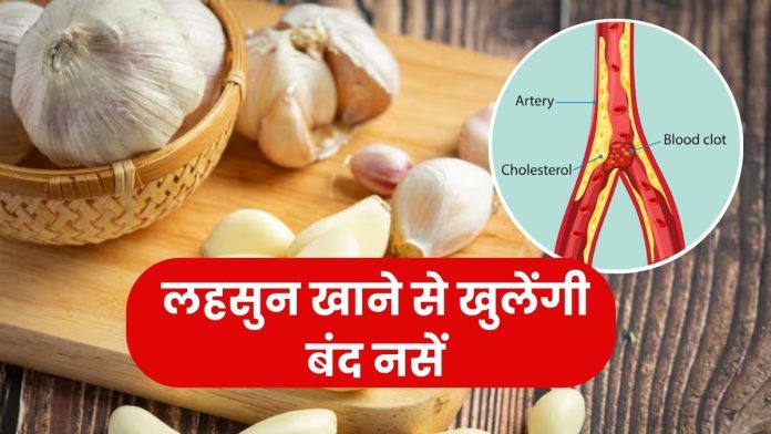 20 करोड़ लोग हार्ट ब्लॉकेज की समस्या से परेशान, क्या लहसुन खाने से खुल सकती है बंद नसें?