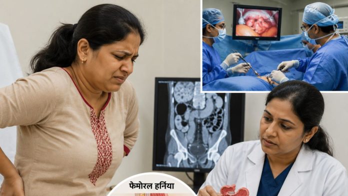 Consultation on femoral hernia treatment