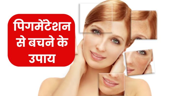पिगमेंटेशन से बचने के आसान उपाय, सनस्क्रीन की हो जाएगी छुट्टी