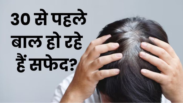 Premature Grey Hair: 30 से पहले बाल हो रहे हैं सफेद? जानिए बड़े कारण