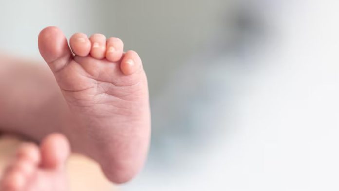 Three-year-old burn injury recovery