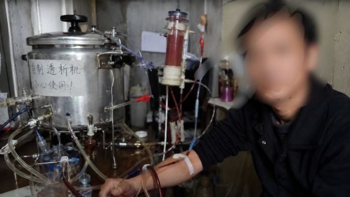 प्रेशर कूकर से बना डायलिसिस मशीन