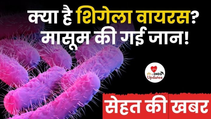 शिगेला वायरस