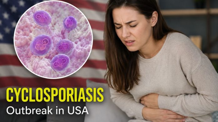 Cyclospora outbreak in USA
