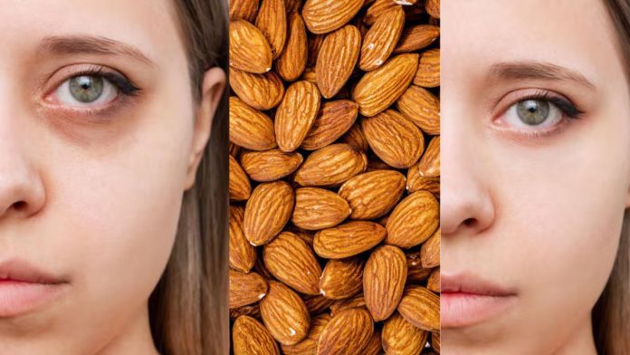 How to Remove Dark Circles: मत फेंकिए बादाम के छिलके, आएंगे बड़े काम