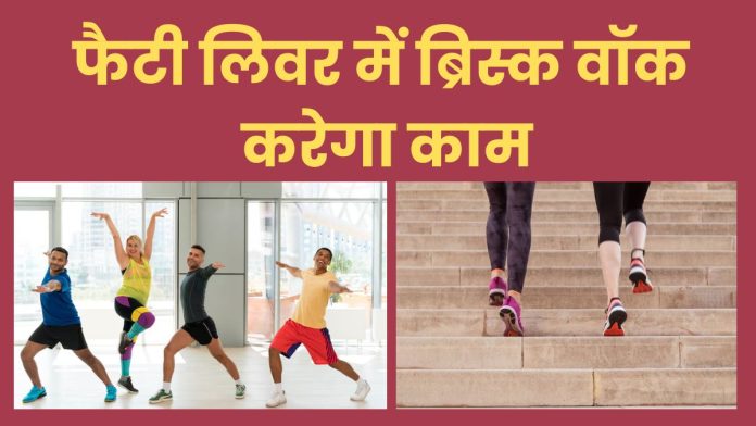 Fatty Liver में ये एक्सरसाइज, एक्सपर्ट ने बताए असरदार आसान