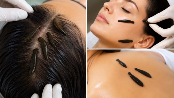Hair Growth: स्किन और हेयर ट्रीटमेंट के लिए Leech Therapy का इस्तेमाल, जानिए कैसे करती है काम
