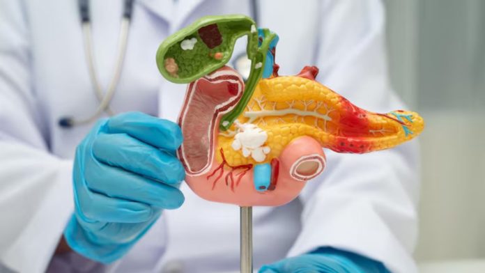 Fatty Pancreas Disease