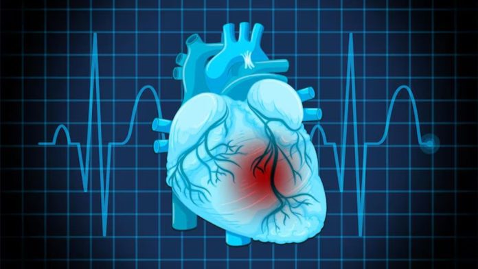 Atrial Fibrillation Symptoms And Causes